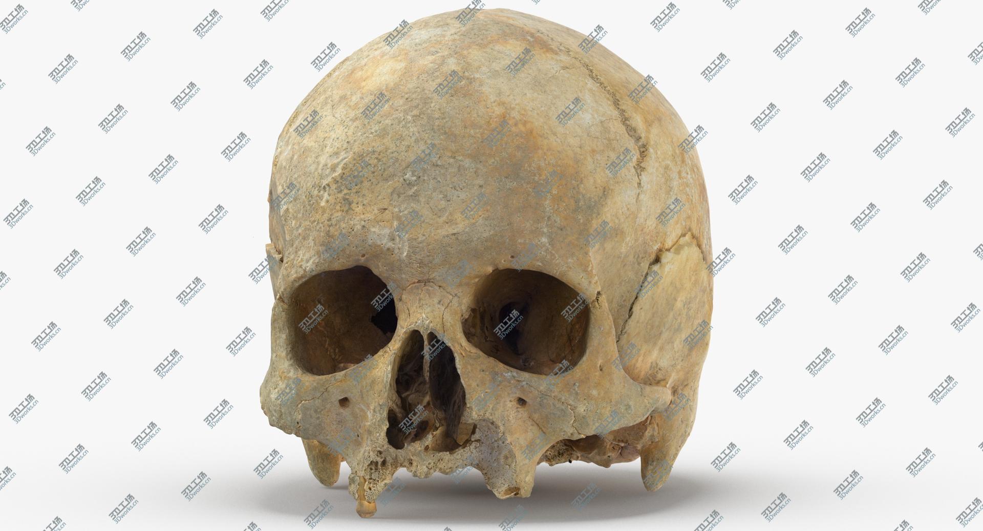 images/goods_img/202104023/Real Human Skull Cranium with Leprosy 01 3D model/4.jpg